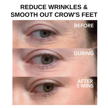 Instant Eye Tightener ~ Erase wrinkles and refresh eyes instantly~