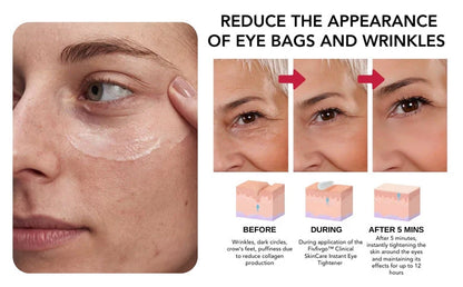 Instant Eye Tightener ~ Erase wrinkles and refresh eyes instantly~